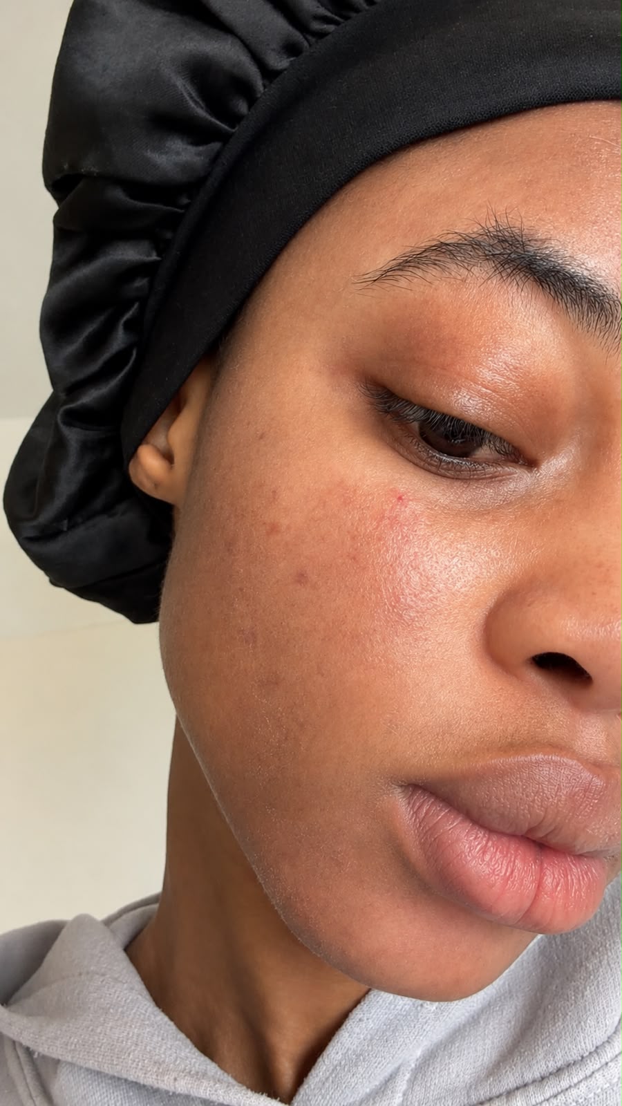 Registo partilhado por cliente do Acnes Oil Control